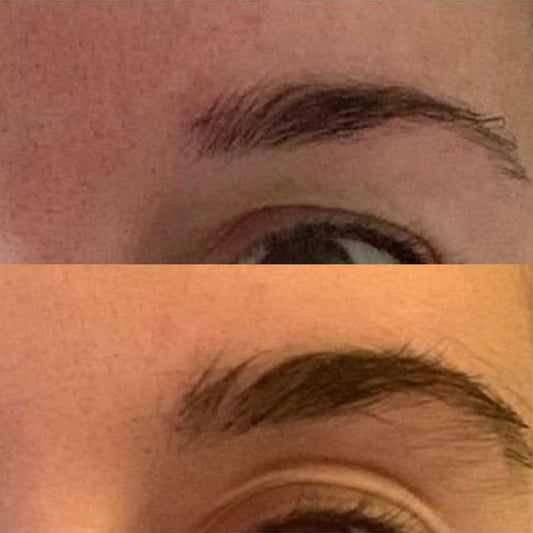 RapidBrow® Results