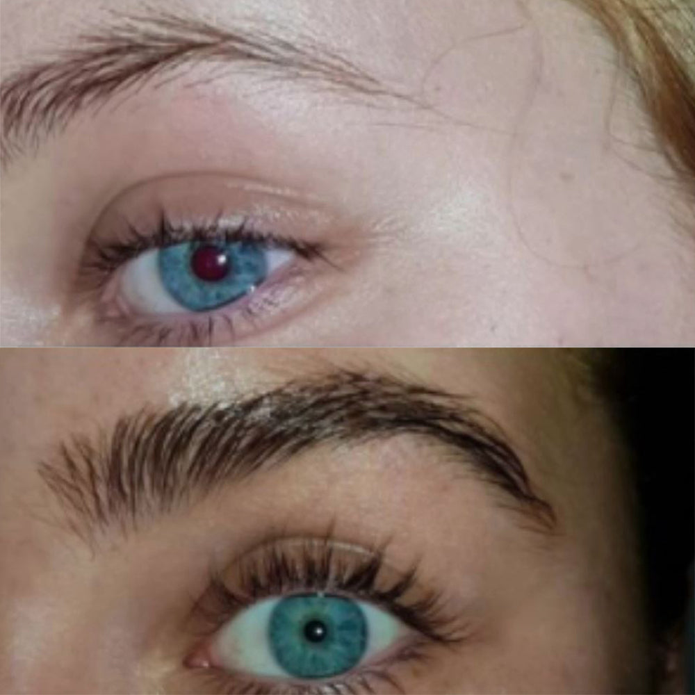 RapidBrow® Eyebrow Enhancing Serum